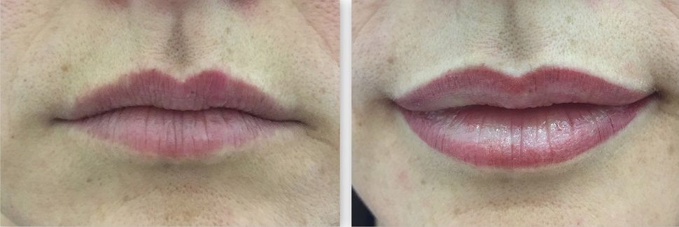 Lippenkontur - Lippenverschönerungen - Permanent Make Up Saarland